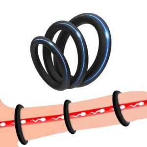 Locking ring-C001