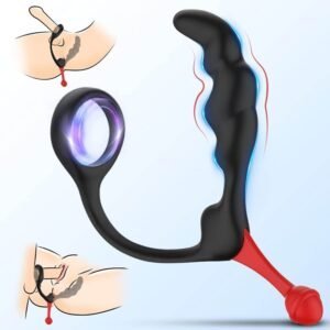 Locking ring-992